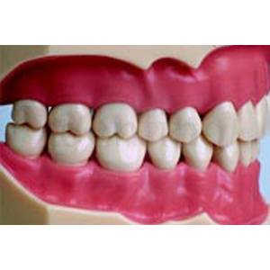 SERIE 32 DIENTES RECAMBIO UNIVERSAL