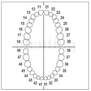 AG3ZE010 nº 15 dientes 10 ud