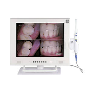 CAMARA INTRAORAL CON SISTEMA AUTOFOCUS Y ACOPLE BRAZO